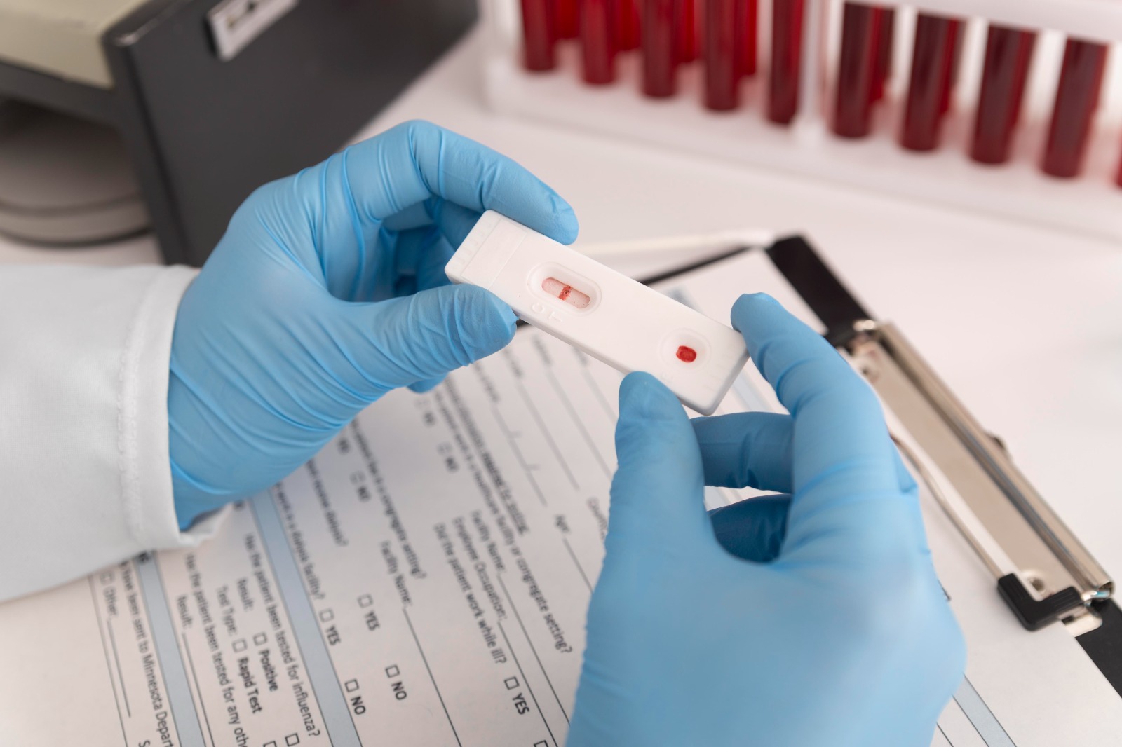 Saúde promove testes rápidos para HIV e outras doenças