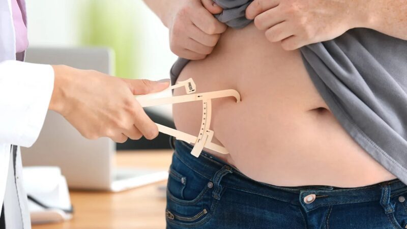 Cirurgia Bariátrica em Alta: Um Novo Olhar para o Tratamento da Obesidade no Brasil